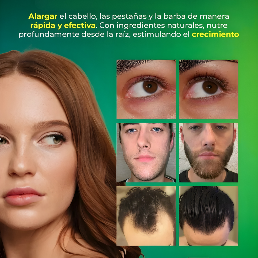 OUHOE SPRAY TÓNICO CAPILAR – Fortalece, estimula y renueva tu cabello desde la raíz